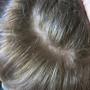dandruff solution in urdu Dandruff tips for hair