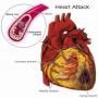 five disease control pills combined into single pill