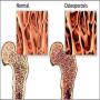 Most of the people in Pakistan are suffering from muscular and bones problems