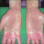 Winter skin is prone to various problems