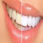 Clean and shiny teeth making simple home Tips